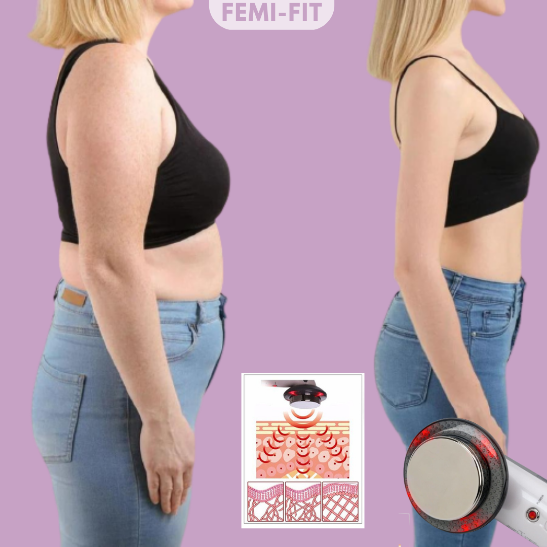 3-in-1 Vet and Cellulite Remover - SlimShape-Nora Luxe