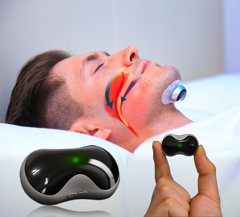 Comfortable Anti-Snoring Device - QuietWave-Anti-snoring device-Nora Luxe